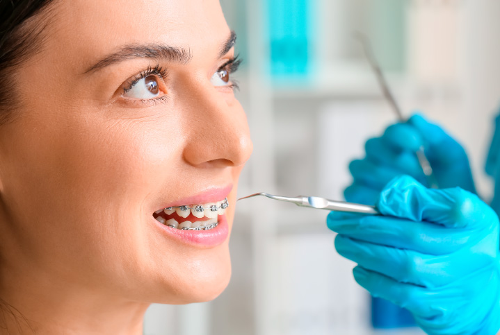 Mujer con frenillos va a su control con el dentista quien revisa sus brackets de ortodoncia